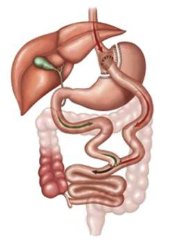 terapia-2-desvio-bypass-gastrico